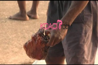 Benin : Des trafiquants de cranes humains arrêtés